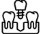 Dental Implantts