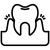 gingivitis (1)