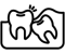 wisdom tooth removal